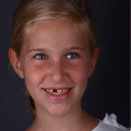 portfolio image before